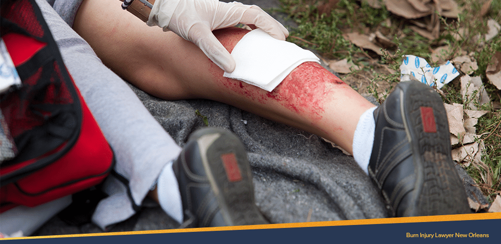 first degree burn from a child laid down on the ground being treated