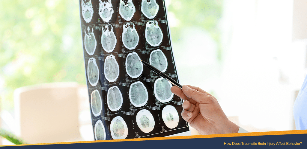 Unseen woman pointing a pen to a traumatic brain injury x-ray