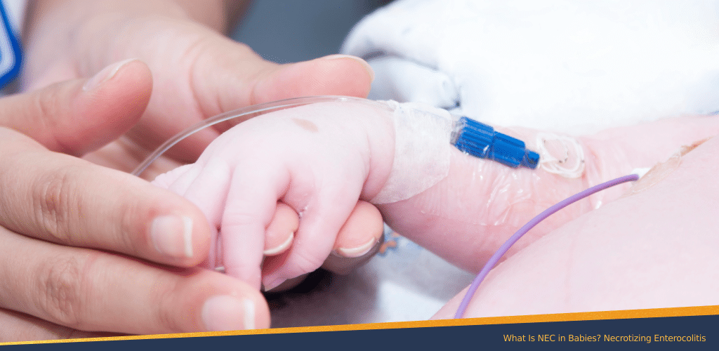 Close-up of a doctor gently holding a newborn's hand with an IV, representing medical care for infants affected by necrotizing enterocolitis (NEC).